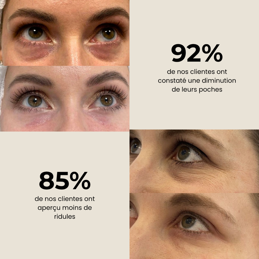 Patchs Anti-Cernes au Charbon de Bambou